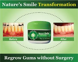 Nature's Smile Transmission